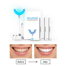 Charger l'image dans la galerie, Kit Blanchiment Dentaire Pro