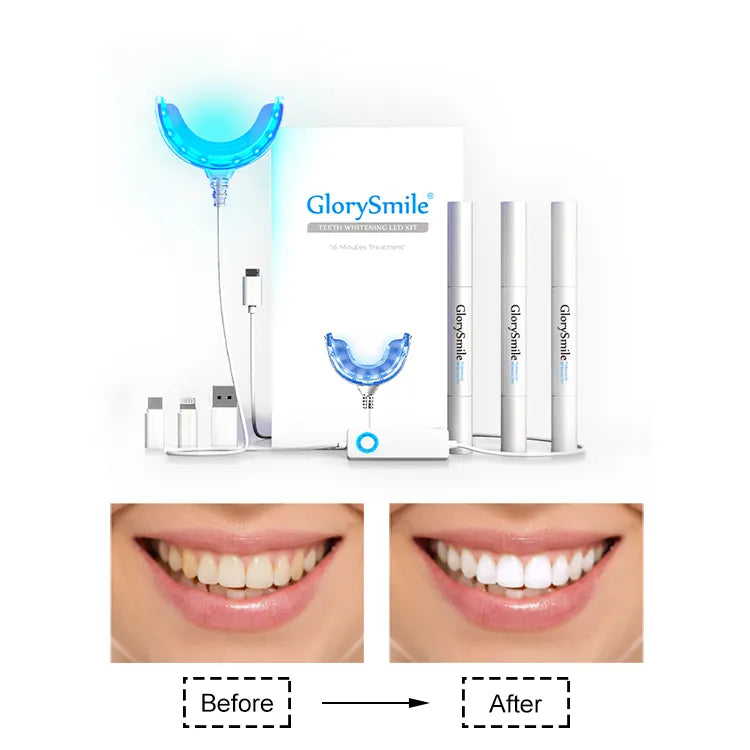 Kit Blanchiment Dentaire Pro